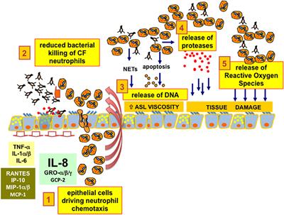 Role of Cystic Fibrosis Bronchial Epithelium in Neutrophil Chemotaxis